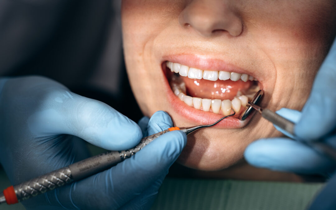 5 Tips For a Relaxing Dentist Visit