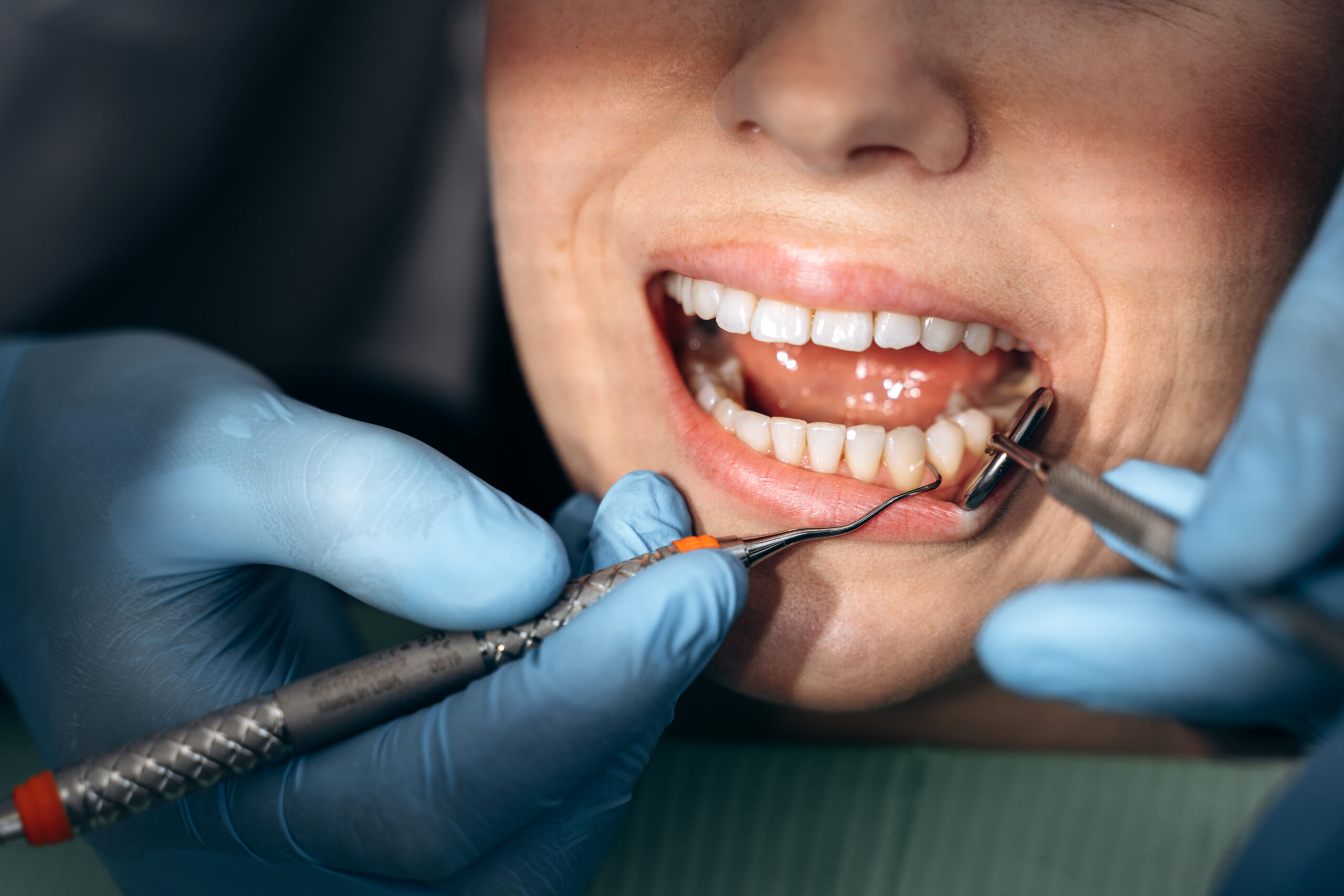5 Tips For a Relaxing Dentist Visit