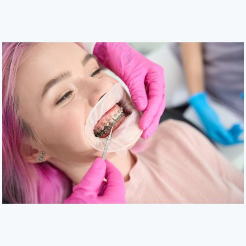 How Investing in Orthodontics Helps Your Long-Term Dental Health