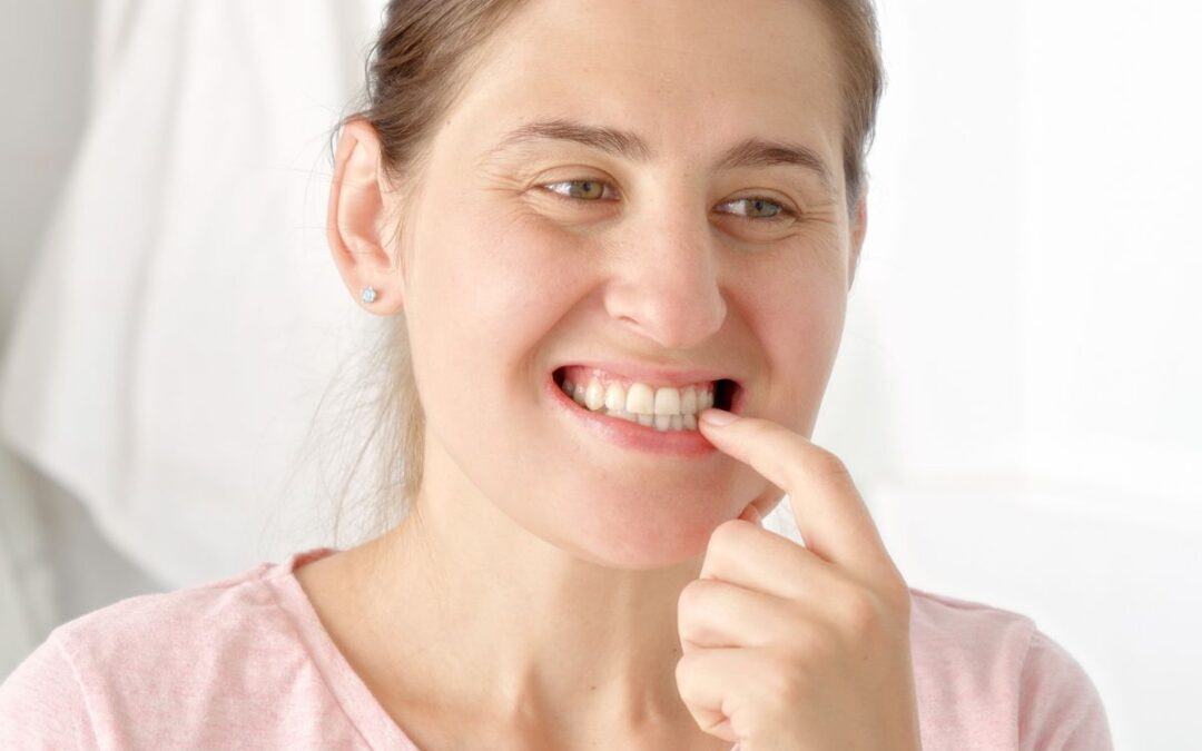 Can Teeth Grinding Lead to Broken Teeth?