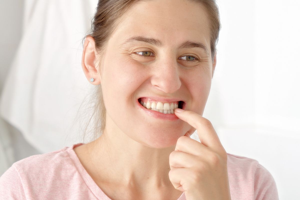 Can Teeth Grinding Lead to Broken Teeth?