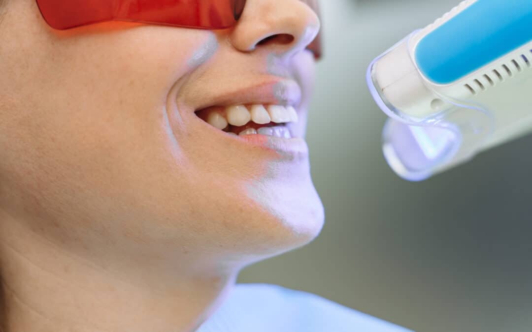 The Biggest Teeth Whitening Mistakes People Make