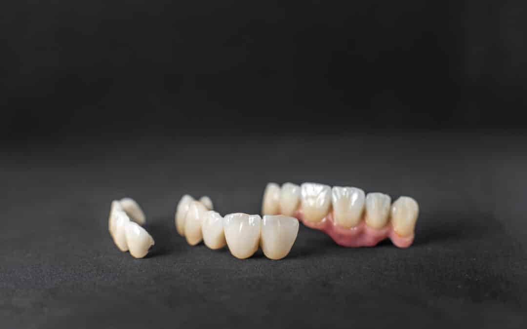 What to Expect When Getting Your First Dental Crown