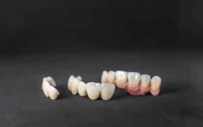 What to Expect When Getting Your First Dental Crown