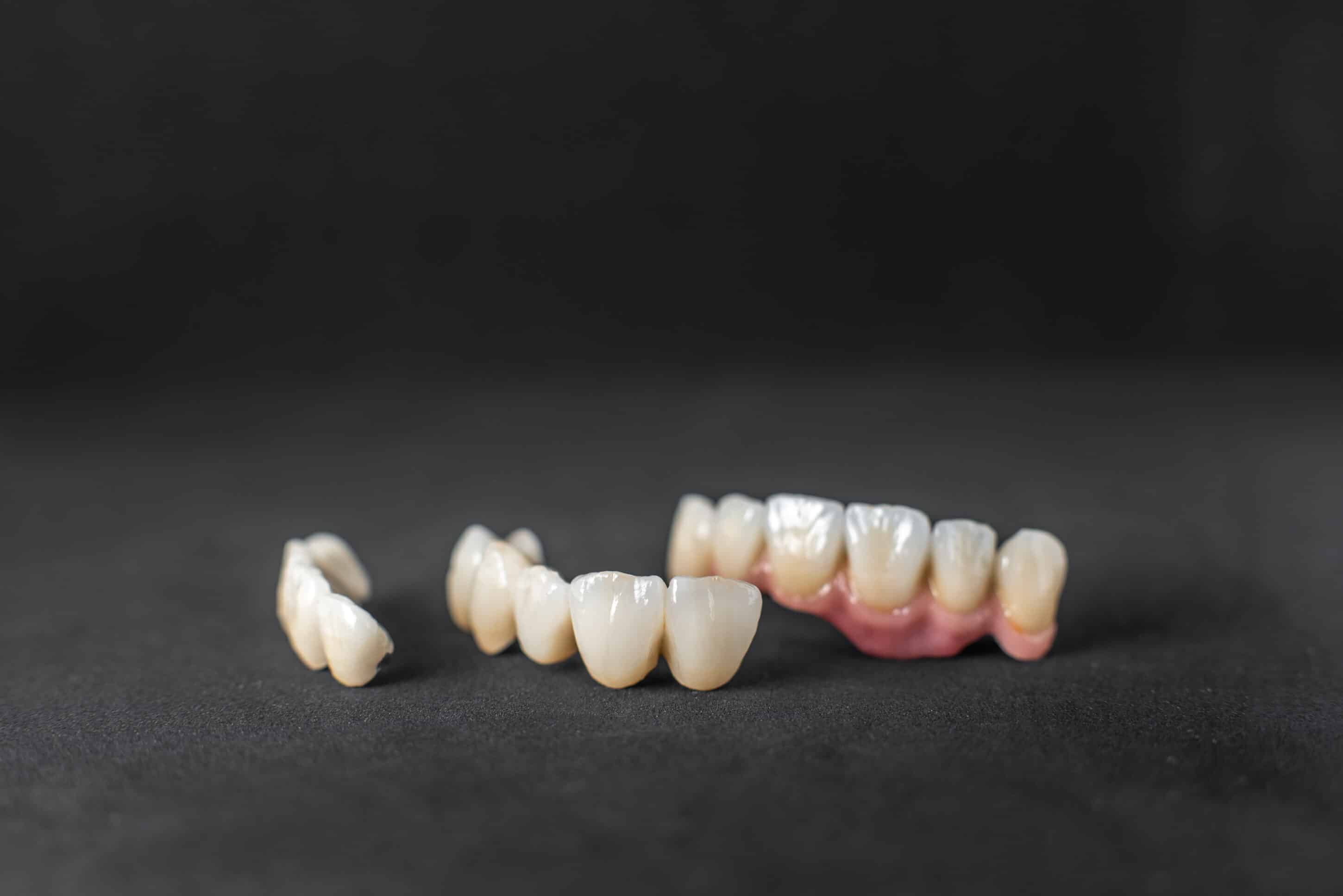 What to Expect When Getting a Dental Crown