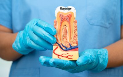 Are Dental Implants Painful? The Truth About Surgery and Recovery