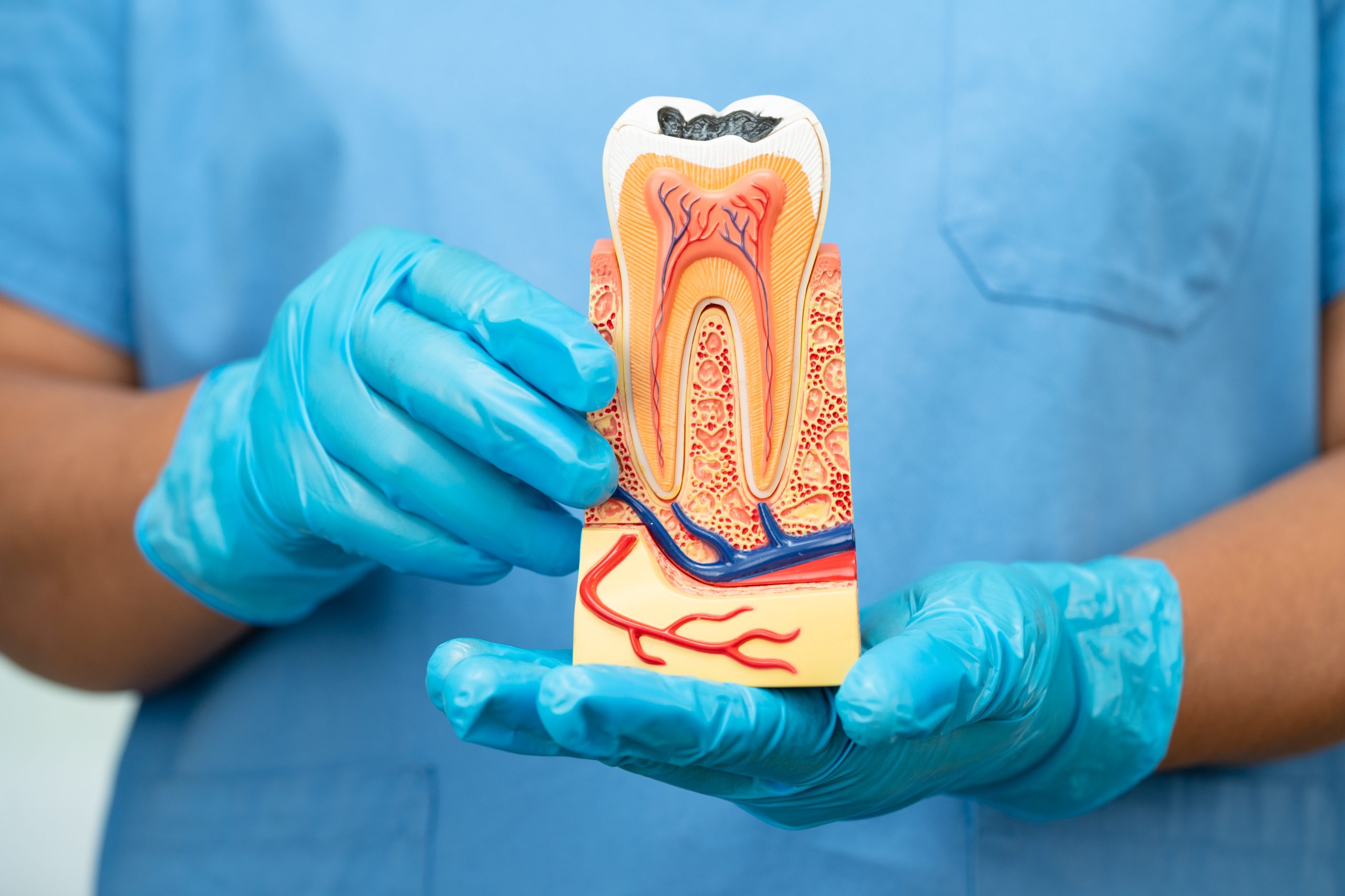Are Dental Implants Painful? Surgery & Recovery